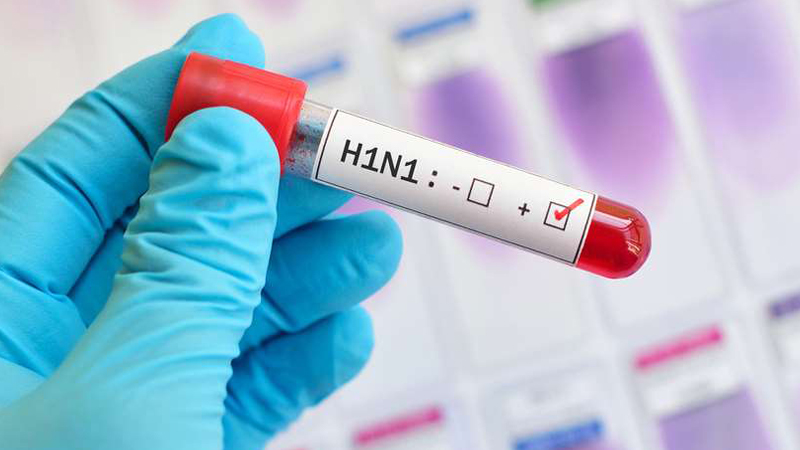 საქართველოში H1N1-ით რვა ადამიანი გარდაიცვალა