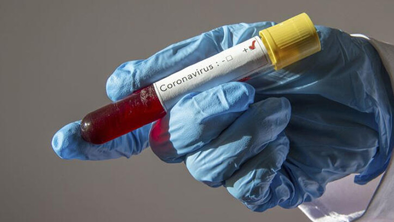 საქართველოში კორონავირუსით ინფიცირებული პაციენტების რაოდენობა 61–მდე გაიზარდა