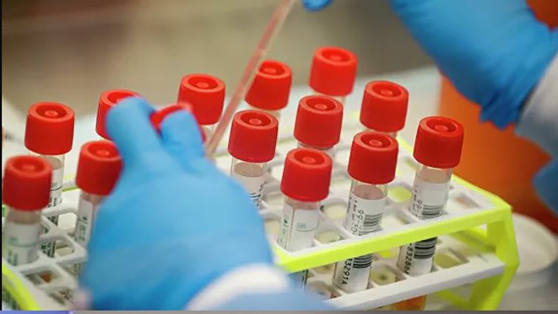 საქართველომ 20 000 ახალი PCR ტესტი მიიღო