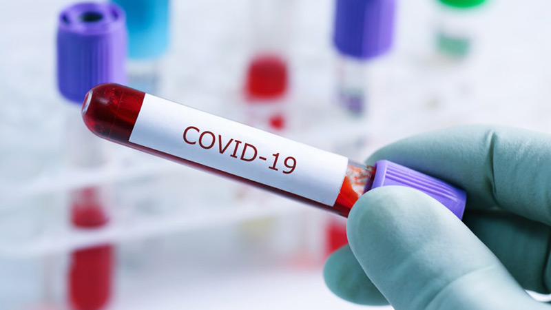 COVID 19-ით ინფიცირების შემთხვევათა რაოდენობა 416–მდე გაიზარდა