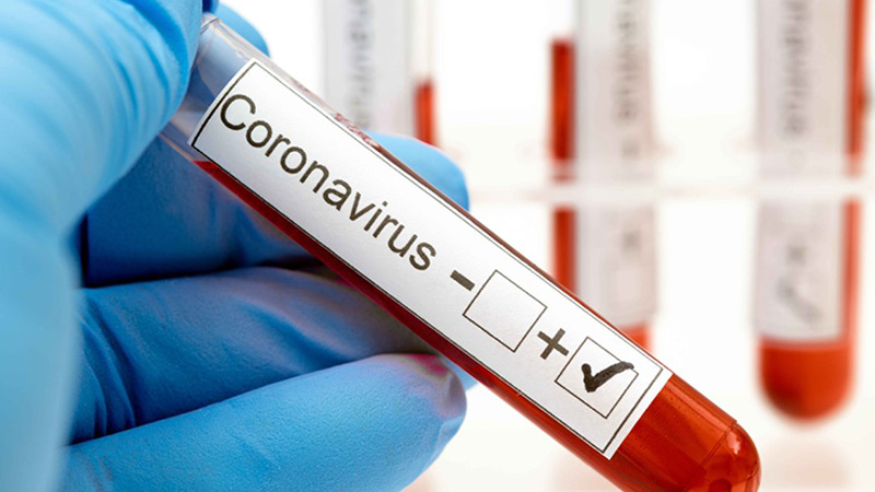 საქართველოში კორონავირუსისგან კიდევ 32 ადამიანი განიკურნა