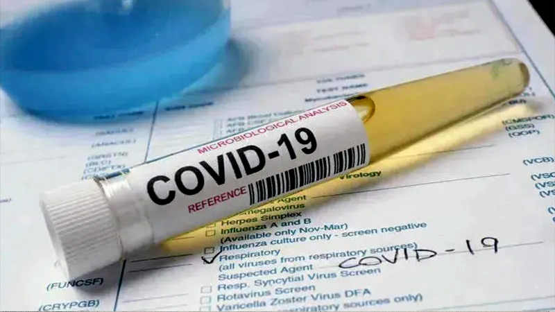 საქართველოში კორონავირუსის 7 ახალი შემთხვევა და 7 გამოჯანმრთელებულია